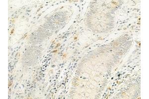 ABIN6265717 and ABIN6279876 at 1/100 staining human normal placenta tissue by IHC-P. (TRAPPC5 Antikörper  (Internal Region))