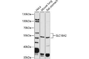 Western blot analysis of extracts of various cell lines, using SLC18 antibody (799) at 1:2000 dilution. (SLC18A2 Antikörper)