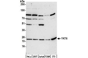anti-YKT6 V-SNARE Homolog (YKT6) (AA 145-195) antibody