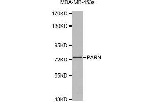 Western blot analysis of extracts of MDA-MB-453s cell lines, using PARN antibody. (PARN Antikörper  (AA 1-280))