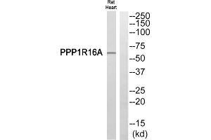 Western blot analysis of extracts from Rat heart cells, using PPP1R16A antibody. (PPP1R16A Antikörper  (Internal Region))