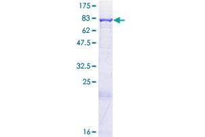 Image no. 1 for Acyl-CoA Dehydrogenase Family, Member 9 (ACAD9) (AA 1-621) protein (GST tag) (ABIN1305582) (ACAD9 Protein (AA 1-621) (GST tag))