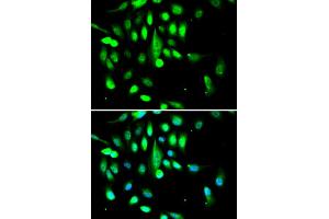 Immunofluorescence analysis of A549 cells using CDK1 antibody. (CDK1 Antikörper)