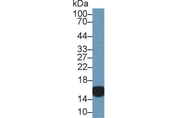 CRABP2 Antikörper  (AA 1-138)