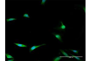 Immunofluorescence of purified MaxPab antibody to ENOPH1 on HeLa cell. (MASA Antikörper  (AA 1-261))