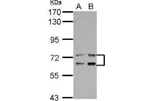 WB Image Sample (30 ug of whole cell lysate) A: Jurkat B: Raji 7. (LTA4H Antikörper)
