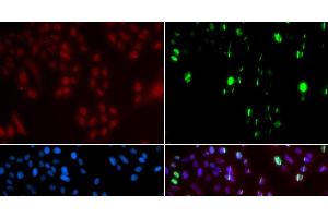 Immunofluorescence analysis of GFP-RNF168 transgenic U2OS cells using FANCD2 Polyclonal Antibody (FANCD2 Antikörper)
