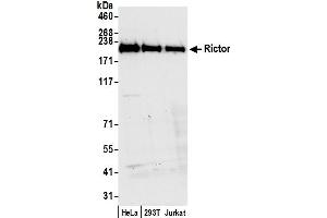 Western Blotting (WB) image for anti-RPTOR Independent Companion of mTOR, Complex 2 (RICTOR) (C-Term) antibody (ABIN7454633) (RICTOR Antikörper  (C-Term))