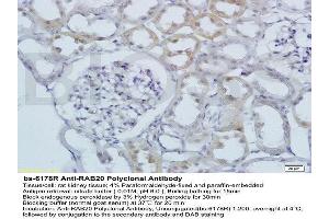 Formalin-fixed and paraffin embedded rat kidney labeled with Anti RAB20 Polyclonal Antibody, Unconjugated  at 1:200 followed by conjugation to the secondary antibody and DAB staining (RAB20 Antikörper  (AA 131-234))