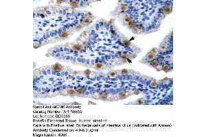 Human Lung (MCM6 Antikörper  (C-Term))