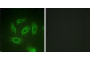 Immunofluorescence (IF) image for anti-Transforming Growth Factor, beta Receptor 1 (TGFBR1) (AA 131-180) antibody (ABIN2888904) (TGFBR1 Antikörper  (AA 131-180))