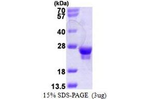 SDS-PAGE (SDS) image for RAB18, Member RAS Oncogene Family (RAB18) (AA 1-206) protein (His tag) (ABIN667980) (RAB18 Protein (AA 1-206) (His tag))