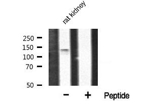Western blot analysis of FGFR1 phosphorylation expression in rat kidney tissue lysates,The lane on the right is treated with the antigen-specific peptide. (FGFR1 Antikörper  (pTyr766))
