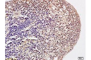 Formalin-fixed and paraffin embedded mouse spleen labeled with Anti Acetyl-Histone H3 Polyclonal Antibody, Unconjugated (ABIN703916) at 1:200 followed by conjugation to the secondary antibody and DAB staining