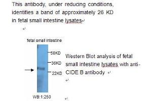 Image no. 1 for anti-Cell Death-Inducing DFFA-Like Effector B (CIDEB) antibody (ABIN790841) (CIDEB Antikörper)