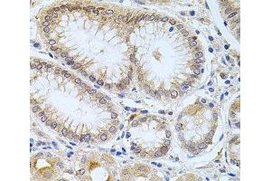 Immunohistochemistry of paraffin-embedded Human stomach using CPM Polyclonal Antibody at dilution of 1:100 (40x lens). (CPM Antikörper)