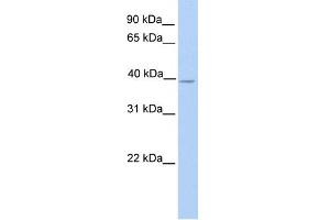 WB Suggested Anti-NEK6 Antibody Titration:  0. (NEK6 Antikörper  (N-Term))