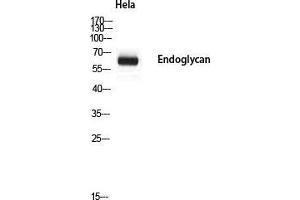 Western Blot (WB) analysis of HeLa using Endoglycan antibody. (PODXL2 Antikörper)