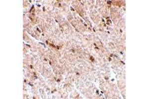 Immunohistochemistry (IHC) image for anti-Mitogen-Activated Protein Kinase Associated Protein 1 (MAPKAP1) (Middle Region) antibody (ABIN1030995)