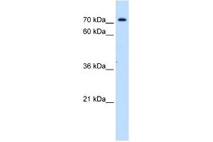 SLC5A11 antibody used at 1 ug/ml to detect target protein.