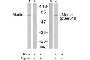Image no. 2 for anti-Neurofibromin 2 (NF2) (pSer518) antibody (ABIN197028) (Merlin Antikörper  (pSer518))