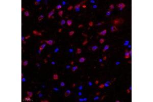 Immunofluorescence of paraffin embedded rat substantia nigra using C1orf173 (ABIN7074073) at dilution of 1: 650 (400x lens) (Glutamate-Rich Protein 3 (ERICH3) Antikörper)