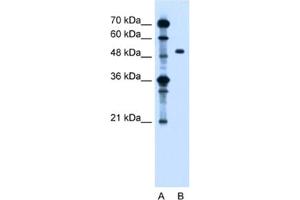 Western Blotting (WB) image for anti-Zinc Finger, FYVE Domain Containing 27 (ZFYVE27) antibody (ABIN2462817) (ZFYVE27 Antikörper)