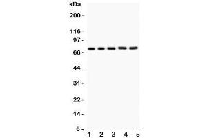 Western blot testing of RIP1 antibody and Lane 1:  Jurkat;  2: 22RV1;  3: MCF-7;  4: HeLa;  5: A549. (RIPK1 Antikörper  (AA 316-671))