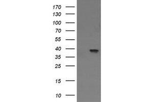 Image no. 1 for anti-Mitogen-Activated Protein Kinase Kinase 3 (MAP2K3) antibody (ABIN1499415) (MAP2K3 Antikörper)
