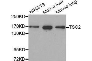 Western Blotting (WB) image for anti-Tuberous Sclerosis 2 (TSC2) antibody (ABIN5663676) (Tuberin Antikörper)