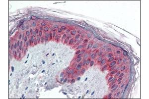 Human Skin (formalin-fixed, paraffin-embedded) stained with VAV3at 5 µg/ml followed by biotinylated anti-goat IgG secondary antibody, alkaline phosphatase-streptavidin and chromogen. (VAV3 Antikörper  (Internal Region))