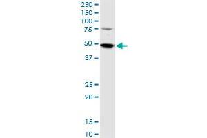 SET7 polyclonal antibody (A01), Lot # 051212JC01.
