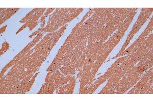 Detection of MBP in Human Cerebrum Tissue using Monoclonal Antibody to Myelin Basic Protein (MBP) (MBP Antikörper  (AA 220-301))