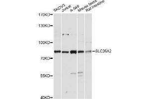 Western blot analysis of extracts of various cell lines, using SLC26A2 antibody. (SLC26A2 Antikörper)