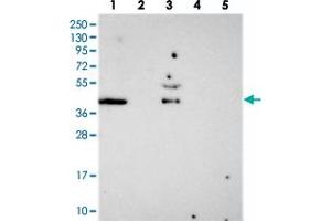 Western blot analysis of Lane 1: RT-4, Lane 2: U-251 MG, Lane 3: Human Plasma, Lane 4: Liver, Lane 5: Tonsil with FAM113B polyclonal antibody . (PCED1B Antikörper)