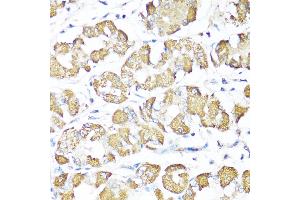 Immunohistochemistry of paraffin-embedded Human stomach using XBP1s antibody (ABIN7271399) at dilution of 1:100 (40x lens). (XBP1 Antikörper  (AA 300-376))