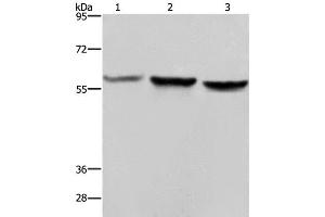 Western Blot analysis of Hela, A375 and LoVo cell using SYN2 Polyclonal Antibody at dilution of 1:1400