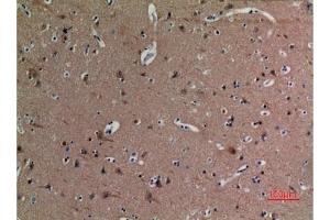 Immunohistochemical analysis of paraffin-embedded human-brain, antibody was diluted at 1:100.