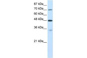 CARS antibody used at 0. (CARS Antikörper  (C-Term))