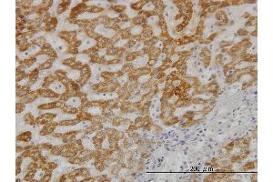 Immunoperoxidase of monoclonal antibody to UBE2G2 on formalin-fixed paraffin-embedded human liver. (UBE2G2 Antikörper  (AA 1-87))