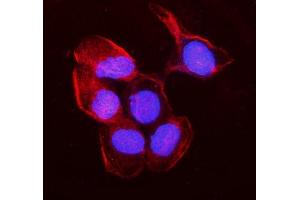 IF analysis of non-muscle Myosin IIB/MYH10 using anti-non-muscle Myosin IIB/MYH10 antibody (ABIN7603186). (MYH10 Antikörper  (N-Term))