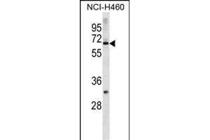 ZN Antibody (N-term) (ABIN1882016 and ABIN2838710) western blot analysis in NCI- cell line lysates (35 μg/lane). (Zinc Finger Protein 185 Antikörper  (N-Term))