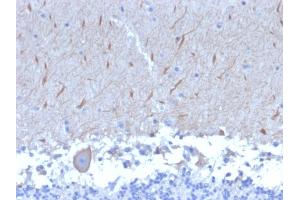 Formalin-fixed, paraffin-embedded human Brain stained with ATG5 Mouse Monoclonal Antibody (ATG5/2553). (ATG5 Antikörper  (AA 1-119))