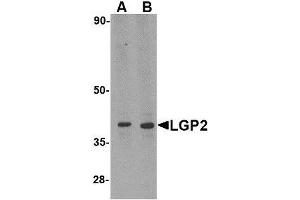 Image no. 1 for anti-DEXH (Asp-Glu-X-His) Box Polypeptide 58 (DHX58) (N-Term) antibody (ABIN1494350) (DHX58 Antikörper  (N-Term))
