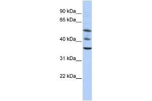 WB Suggested Anti-TRIM68 Antibody Titration:  0. (TRIM68 Antikörper  (Middle Region))