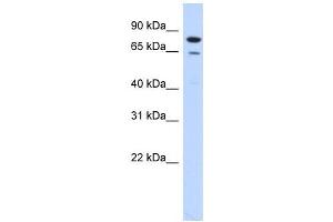RMI1 antibody used at 1 ug/ml to detect target protein. (RMI1 Antikörper)