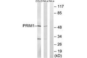 Western blot analysis of extracts from COLO/HeLa cells, using PRIM1 Antibody. (PRIM1 Antikörper  (AA 371-420))