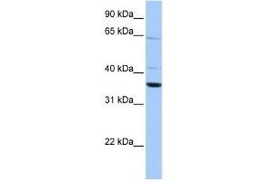 Calponin 2 antibody used at 1 ug/ml to detect target protein.