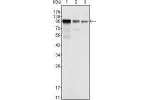 Western blot analysis using FER mouse mAb against NIH/3T3 (1), A549 (2) and SK-MEL-5 (3) cell lysate. (FER Antikörper)