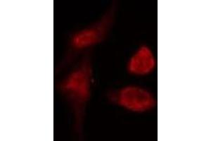 ABIN6274990 staining  COLO205 cells by IF/ICC. (CEP57 Antikörper  (Internal Region))